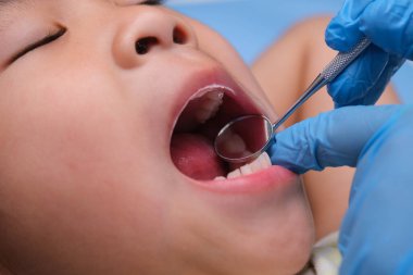 Güzel beyaz dişleri olan sağlıklı bir çocuğun ağız boşluğuna yakın çekim. Genç kız sağlıklı dişleri, sert ve yumuşak damak tadını ortaya çıkarmak için ağzını açar. Diş ve ağız sağlığı kontrolü