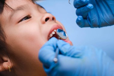 Güzel beyaz dişleri olan sağlıklı bir çocuğun ağız boşluğuna yakın çekim. Genç kız sağlıklı dişleri, sert ve yumuşak damak tadını ortaya çıkarmak için ağzını açar. Diş ve ağız sağlığı kontrolü