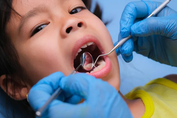Close Cavidade Oral Uma Criança Saudável Com Belos Dentes Brancos — Fotografia de Stock
