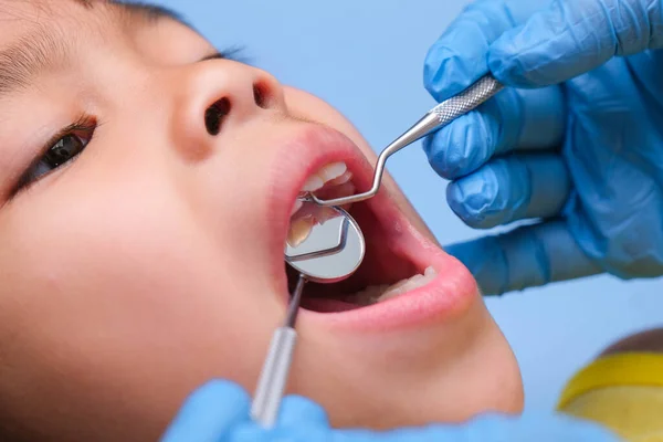 Zbliżenie Jamie Ustnej Zdrowego Dziecka Pięknymi Białymi Zębami Młoda Dziewczyna — Zdjęcie stockowe