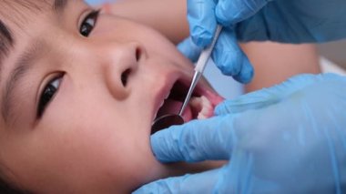 Güzel beyaz dişleri olan sağlıklı bir çocuğun ağız boşluğuna yakın çekim. Genç kız sağlıklı dişleri, sert ve yumuşak damak tadını ortaya çıkarmak için ağzını açar. Diş ve ağız sağlığı kontrolü