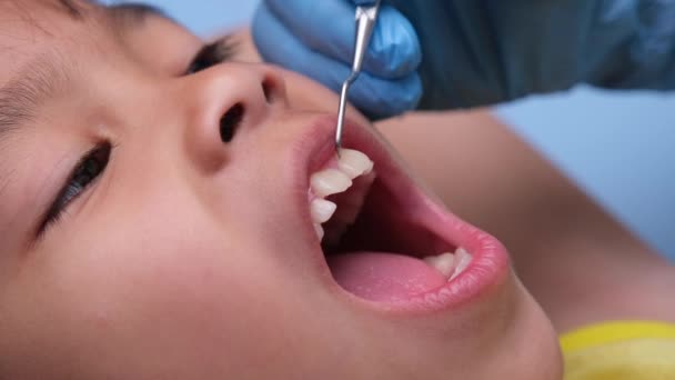 Zbliżenie Jamie Ustnej Zdrowego Dziecka Pięknymi Białymi Zębami Młoda Dziewczyna — Wideo stockowe
