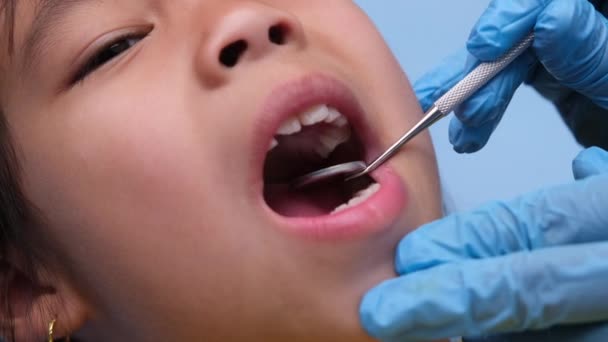 在一个有着漂亮白牙的健康儿童的口腔内进行特写 小女孩张开嘴 露出健康的牙齿 软硬的口感 牙科和口腔卫生检查 — 图库视频影像