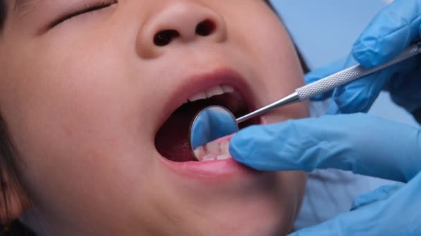 在一个有着漂亮白牙的健康儿童的口腔内进行特写 小女孩张开嘴 露出健康的牙齿 软硬的口感 牙科和口腔卫生检查 — 图库视频影像