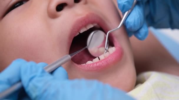 Nahaufnahme Der Mundhöhle Eines Gesunden Kindes Mit Schönen Weißen Zähnen — Stockvideo