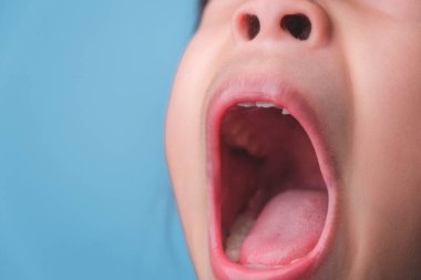 Güzel bebek dişleri olan sağlıklı bir çocuğun ağız boşluğuna yakın çekim. Genç kız ağzını açar üst ve alt dişleri, sert damak tadı, yumuşak damak, diş ve ağız sağlığı kontrollerini gösterir..