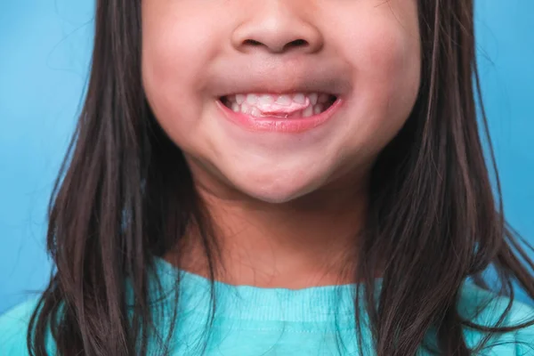 stock image Smiling cute little girl eating sweet gelatin with sugar added isolated on blue background. Children eat sugary sweets, causing loss teeth or tooth decay and unhealthy oral care.