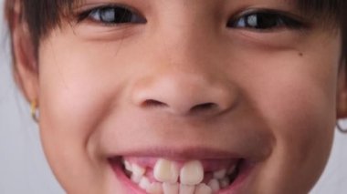 Geniş açıyla gülümseyen, ön dişleri büyüyen, boş bir alan gösteren genç kızın yakın çekimi. Kocaman gülümseyen ve süt dişleri eksik küçük bir kız. Diş sağlığı konsepti