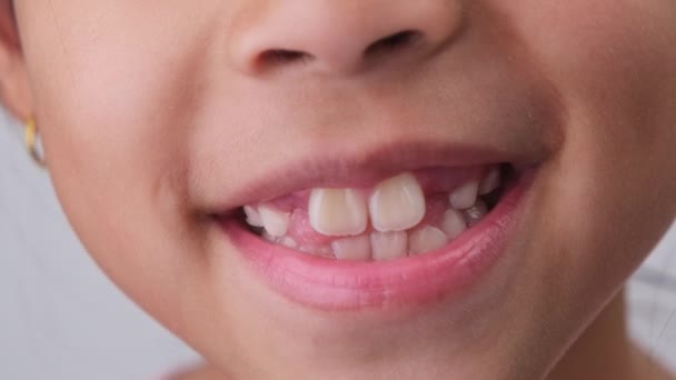 Close Menina Bonito Sorrindo Largo Mostrando Espaço Vazio Com Dentes — Vídeo de Stock