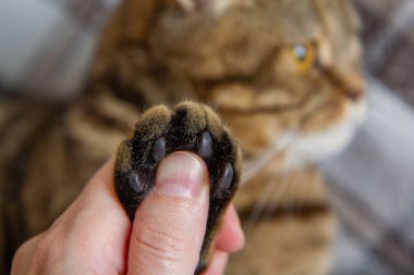 Bir kızın elinde kedi pençesi