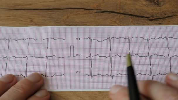 Der Kardiologe Untersucht Das Elektrokardiogramm Ekg Des Patienten — Stockvideo