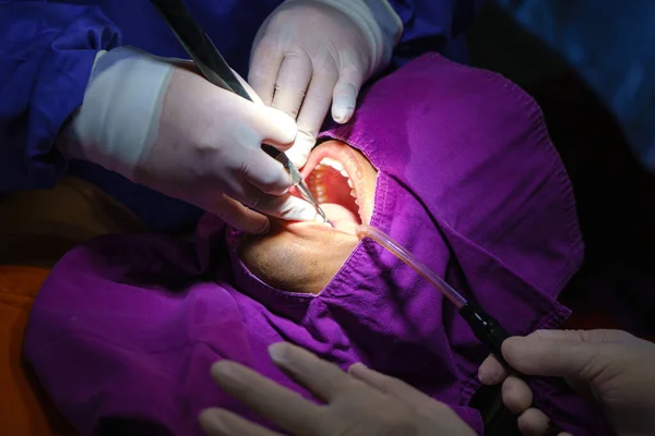 Arzt Reinigt Den Zahnpatienten Mit Ultraschallgerät Entfernung Von Zahnstein Und — Stockfoto