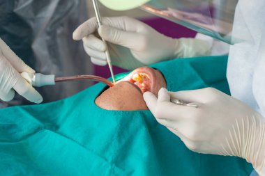 doctor cleaning the teeth patient with ultrasonic too