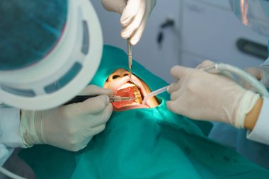 Doktor diş hasta ultrasonik aracı ile Temizleme.