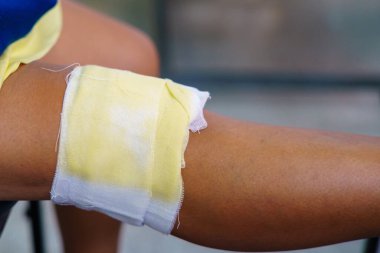Yaşlı bir insanın diz ağrısı Thai bitkisel kompres topu ya da dizinde bitkisel bez kullanır. Diz ağrısı kas gerilmesinden, tendinozdan, diz eklem iltihabından kaynaklanabilir. Tayland geleneksel tıbbı.