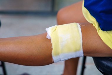 Yaşlı bir insanın diz ağrısı Thai bitkisel kompres topu ya da dizinde bitkisel bez kullanır. Diz ağrısı kas gerilmesinden, tendinozdan, diz eklem iltihabından kaynaklanabilir. Tayland geleneksel tıbbı.