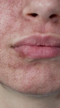 Dudak izi olan kadın dikey olarak krem izi çıkartıyor. Yüksek kalite 4k görüntü