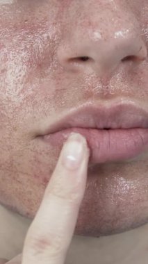 Yüzünde yara izi olan kadın dikey olarak krem izi çıkartıyor. Yüksek kalite 4k görüntü