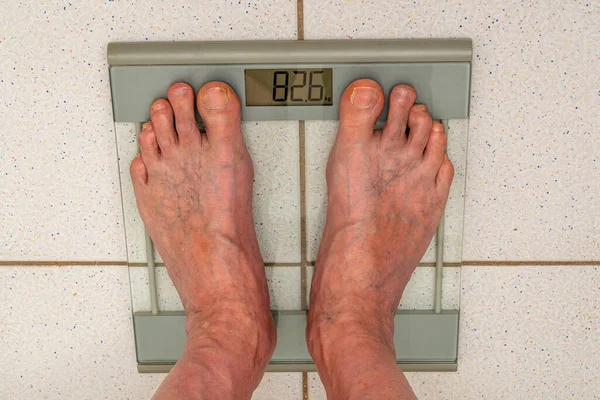 Legs of an elderly man with swollen veins standing on a floor scale. Close up.