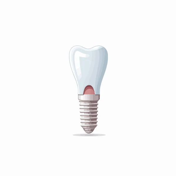 Diş Implantı Vektörü Beyaza Izole Edildi — Stok Vektör