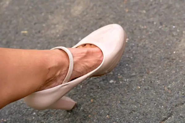 Women\'s problems. Fatigue of legs, heels. Beige shoes