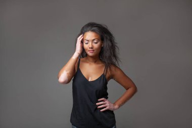 Sensuous female fashion model standing with hand on hip against gray background. Young woman with vitiligo skin disease is wearing black tank top in studio.  clipart