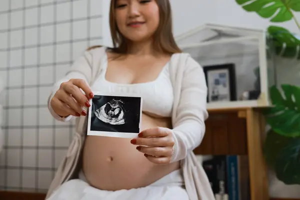 Schwangere Bekommt Ultraschall Mit Druck — Stockfoto