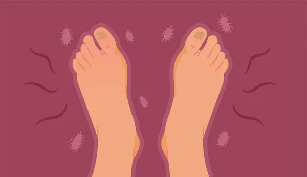 Stinkande Fötter Oskyddade Från Bakterieproblem Vektorillustration — Stock vektor