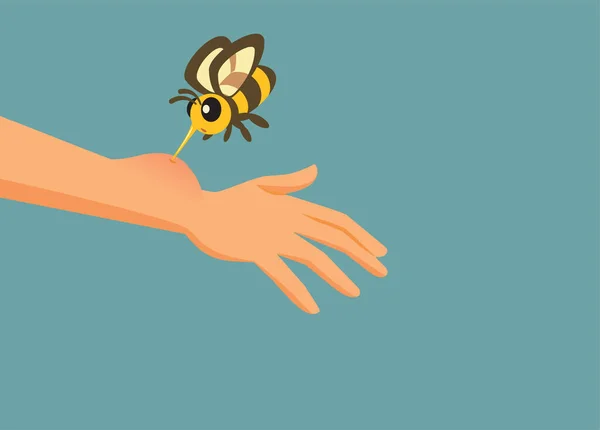 Рука Укушена Пчелой Аллергической Реакцией — стоковый вектор