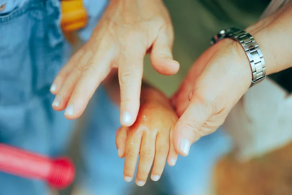 Nanny Tillämpa Sting Relief Cream Handen Liten Flicka — Stockfoto