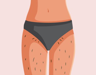 Kıllı Kadın Gövdesi Vücut Pozitif Vektör İllüstrasyonu