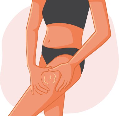 Kadın Bacaklarını Selülit Vektör İllüstrasyonu İçin Kontrol Ediyor