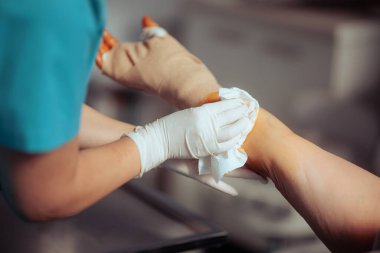 Hemşire, Dezenfektanla Ameliyattan Sonra Hastanın Elini Sildi