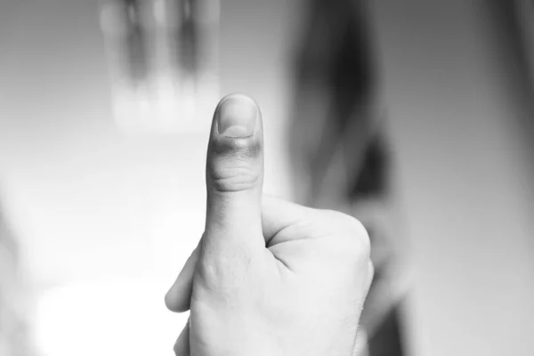Man Suffering Hand Finger Pain — Stock Photo, Image