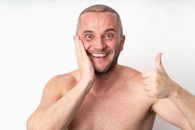 Smiling Man Shows Excitement Post Hair Surgery with Thumbs Up clipart