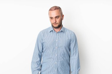 Saç nakli işleminden sonra üzgün bir adamın stüdyo portresi