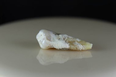 Hasta, hasarlı bir insan dişi. Arka plan siyah ve bulanık. Yakın plan..