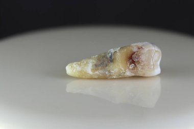 Hasta, hasarlı bir insan dişi. Arka plan siyah ve bulanık. Yakın plan..