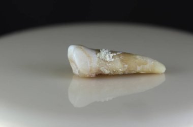 Hasta, hasarlı bir insan dişi. Arka plan siyah ve bulanık. Yakın plan..