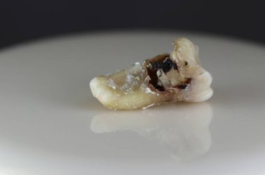 Hasta, hasarlı bir insan dişi. Arka plan siyah ve bulanık. Yakın plan..