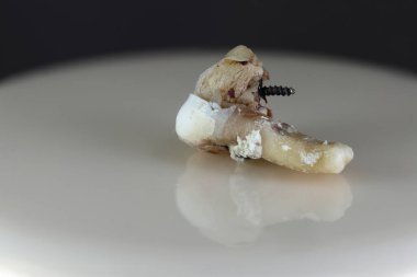 Hasta, hasarlı bir insan dişi. Arka plan siyah ve bulanık. Yakın plan..