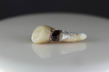 Hasta, hasarlı bir insan dişi. Arka plan siyah ve bulanık. Yakın plan..