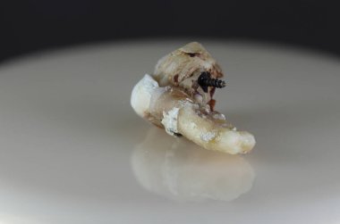 Hasta, hasarlı bir insan dişi. Arka plan siyah ve bulanık. Yakın plan..