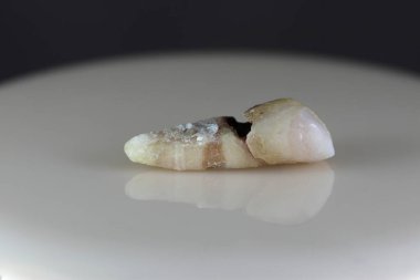 Hasta, hasarlı bir insan dişi. Arka plan siyah ve bulanık. Yakın plan..