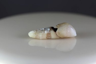 Hasta, hasarlı bir insan dişi. Arka plan siyah ve bulanık. Yakın plan..