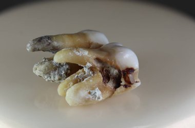 Hasta, hasarlı bir insan dişi. Arka plan siyah ve bulanık. Yakın plan..