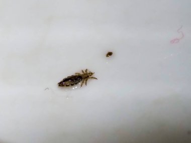 Beyaz bir yüzeyde, küçük kahverengi benekli bir baş bitinin yakın çekimi.