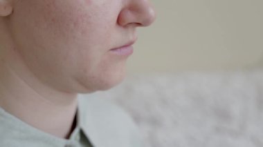 Kafkas bir kadında çift çene. Çenesini çimdikleyen kadın.