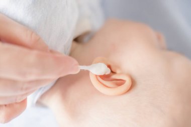 Annenin elleri, bebeğin kulaklarını pamuklu bezle daha dar bir bezle temizler. Kapat. Çocuk kulakları hijyeni. Çocuğun kulağını temizliyorum. Bebeğin kulağından balmumu çıkarıyorum.