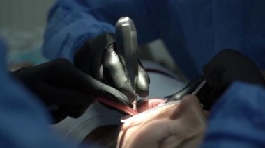 Close-up of dental instruments, during surgery, tooth extraction. Surgeon dentist in black gloves, surgical suit, uniform. Nurse, assistant. Saliva ejector collects blood